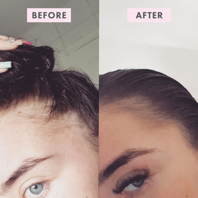 BondiBoost Intensive Growth Spray (125ml) before and after use